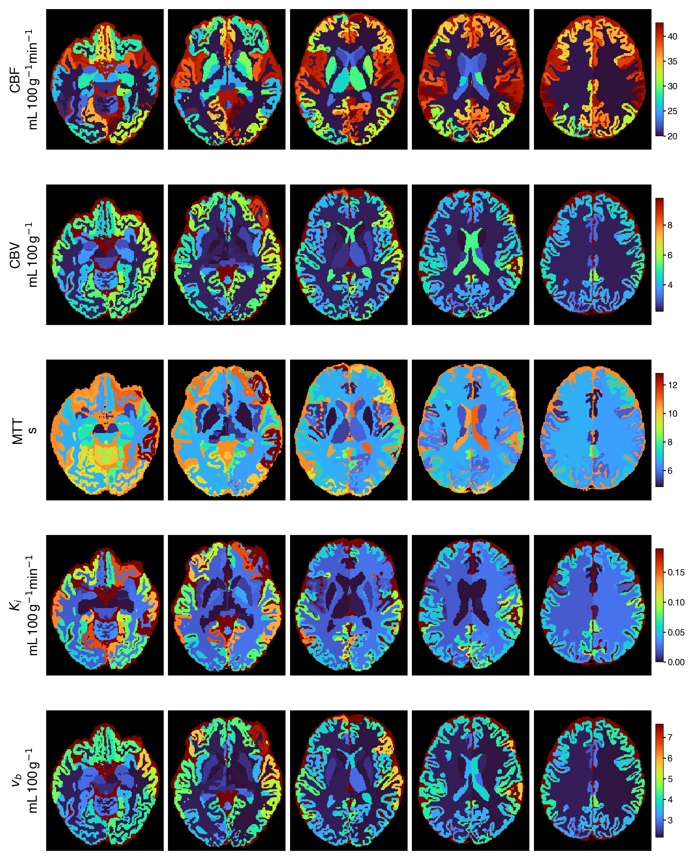 Parcellated output maps