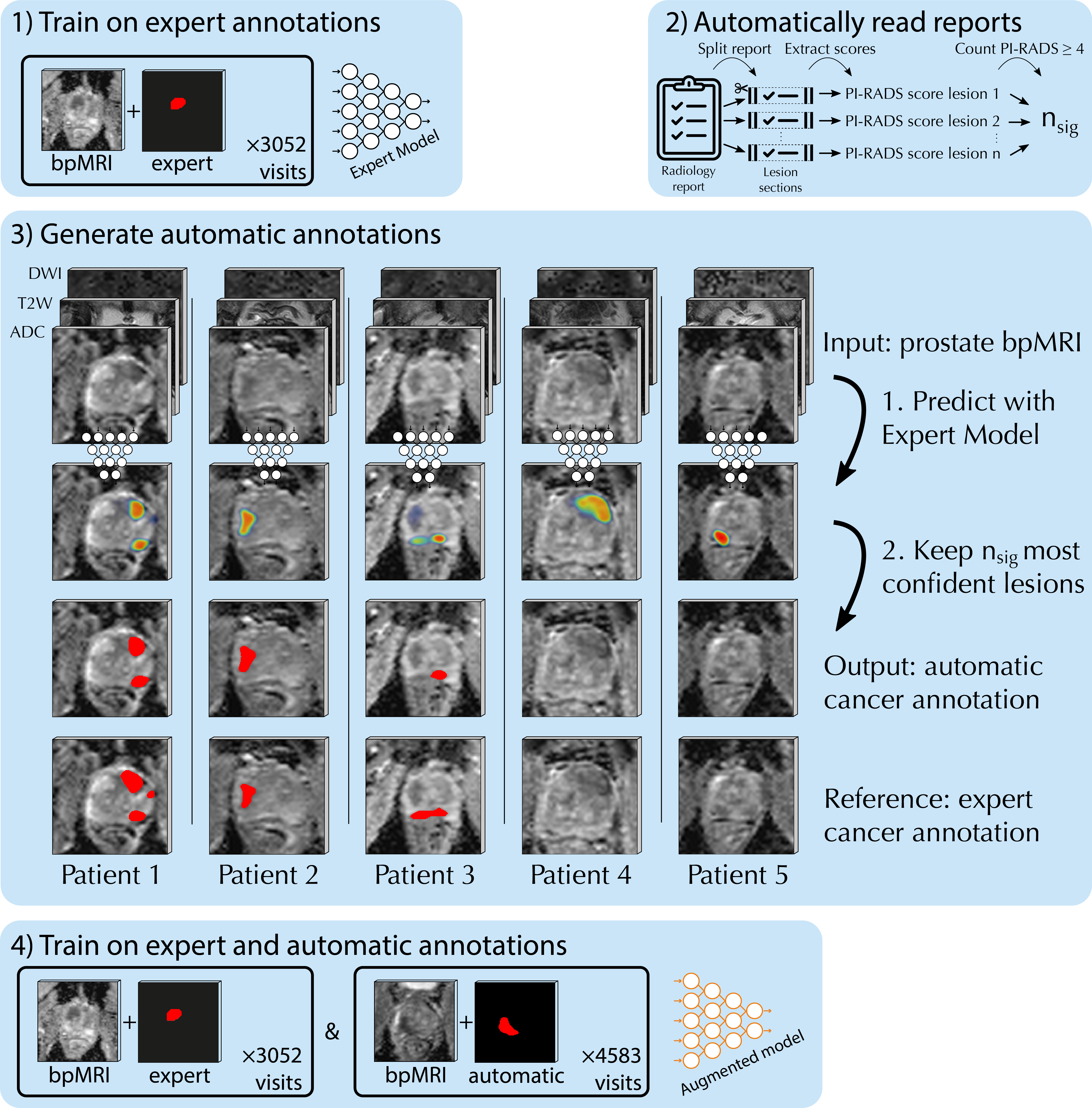 Prostate MRI csPCa Detection with Report Guided Annotations Social