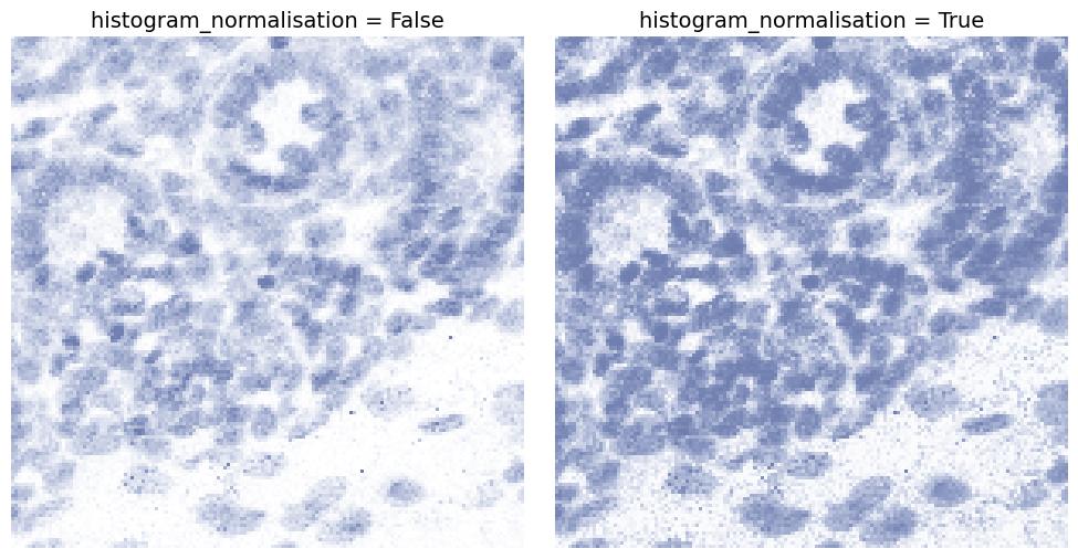 Histogram normalisation