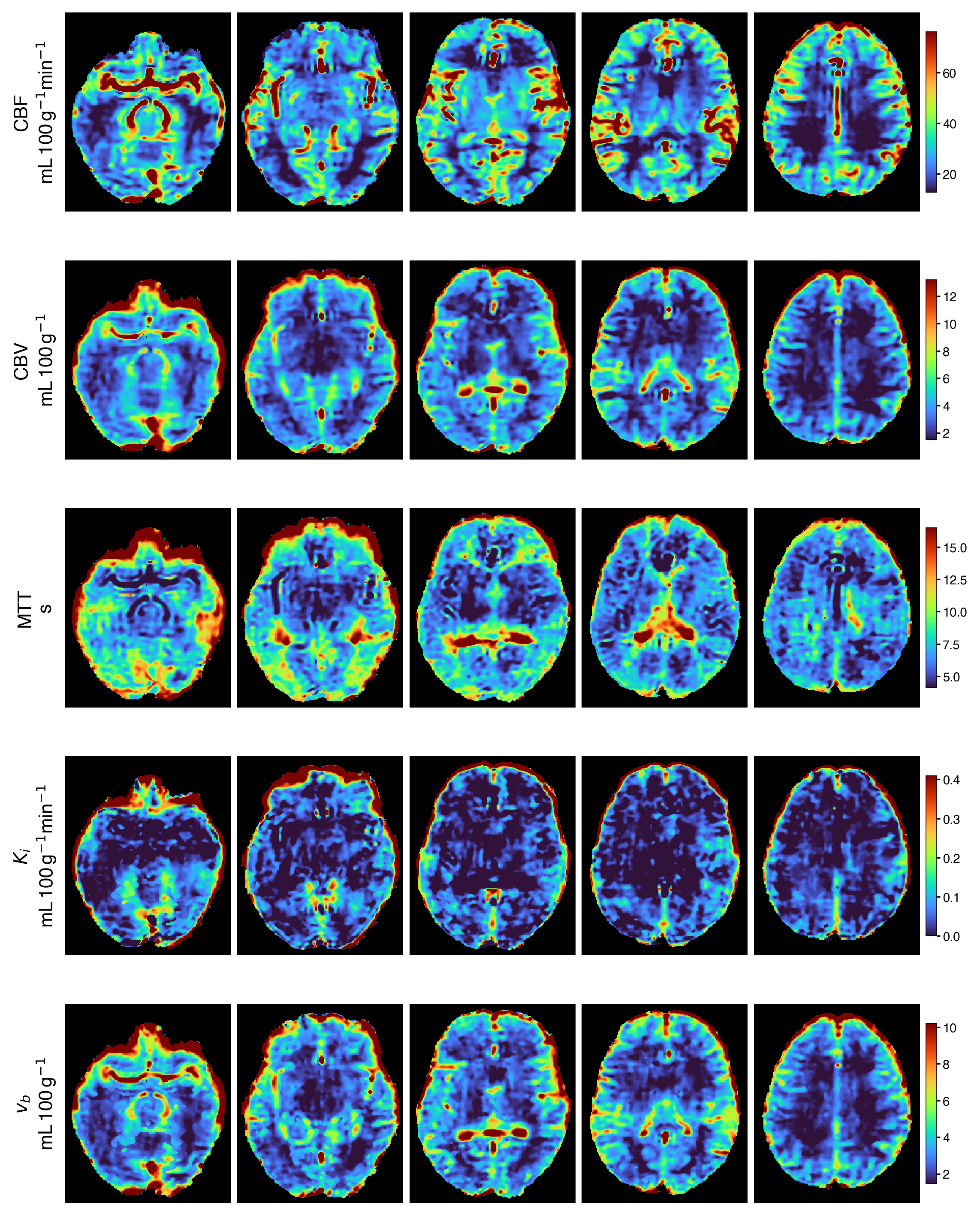 Voxelwise Ki, vb, CBF, MTT and CBV from a single automated pbrain run