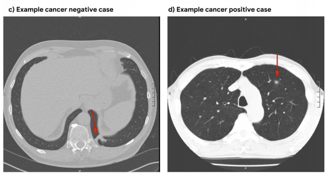 Example cases