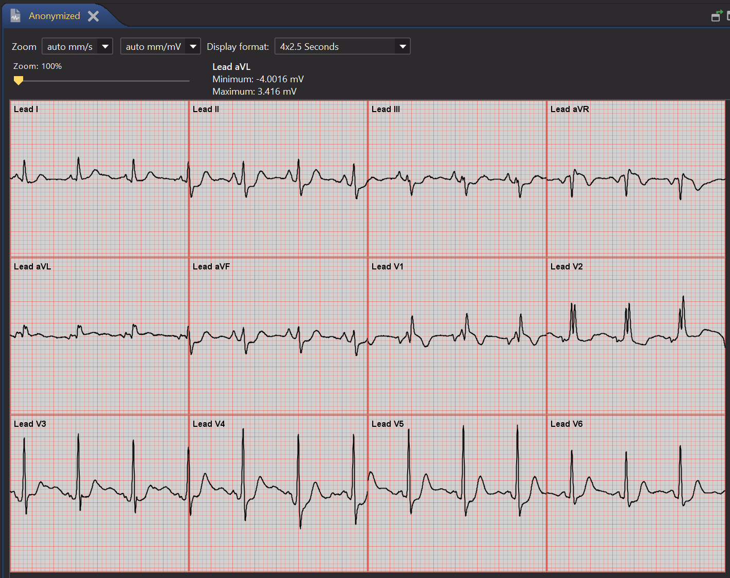 ecg_dicom.png