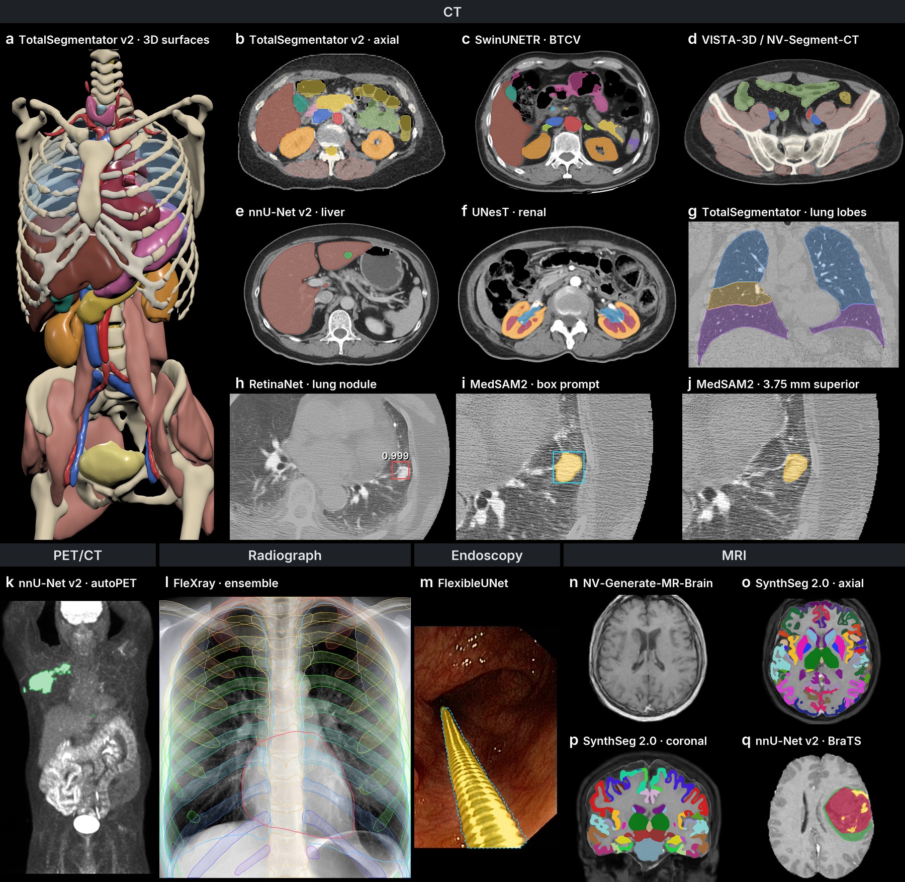 Outputs across CT, PET/CT, radiographs, endoscopy and MRI
