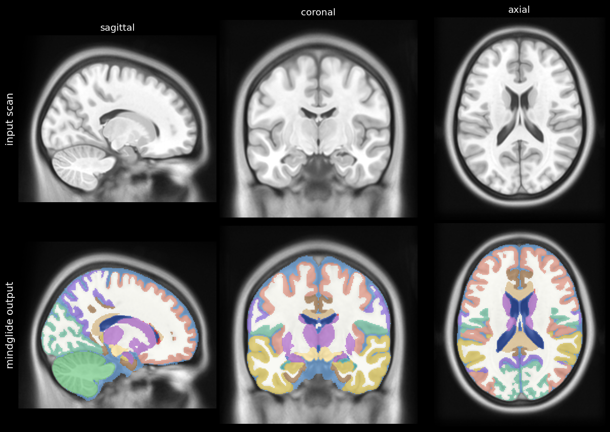 MindGlide segmentation of the MNI152 template: input scan vs segmented output in three views