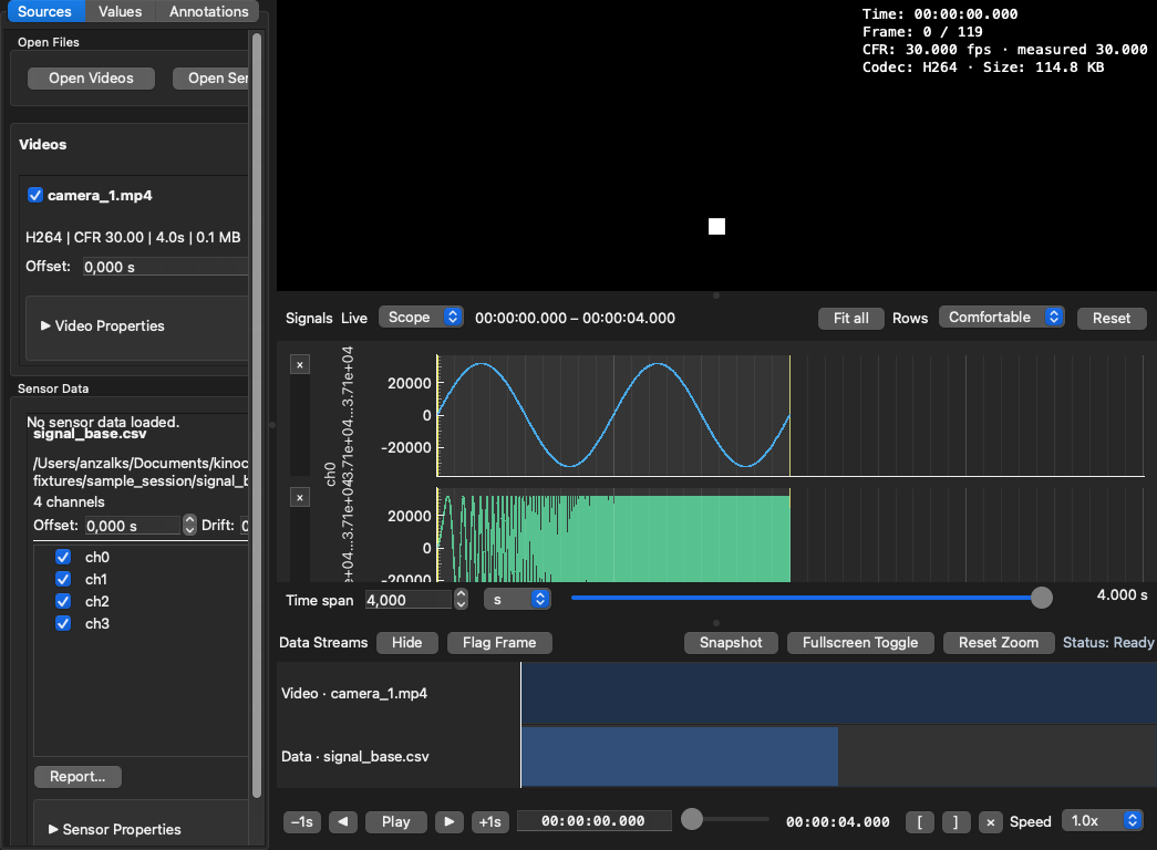 One camera and three signal channels of the bundled sample session on a shared timeline, with the Data Streams coverage bar below.