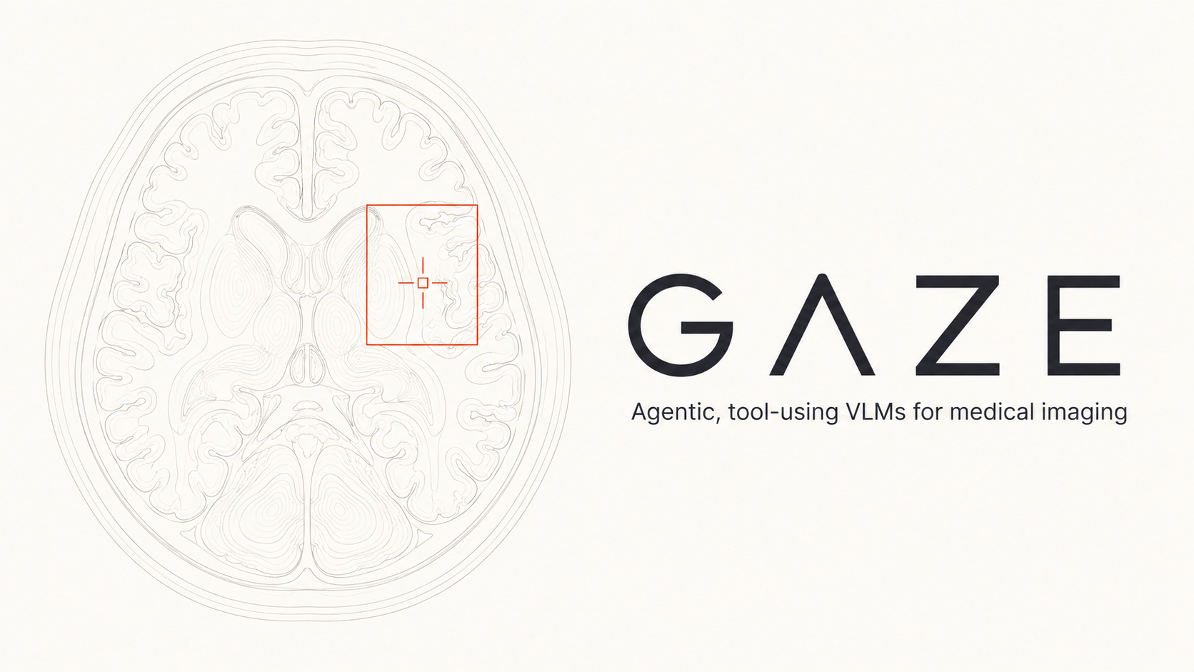 GAZE: Grounded Agentic Zero-shot Evaluation