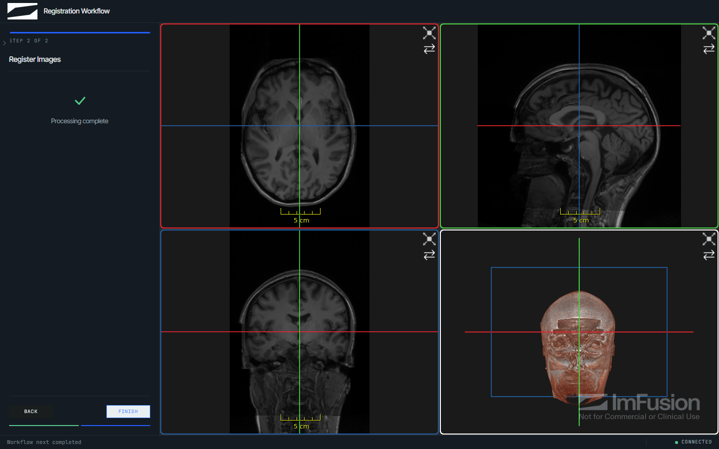The registration example at its input step: three orthogonal views and a 3D rendering of two brain MRI sessions loaded but not yet aligned, a data model listing both sessions, and a workflow panel for assigning the fixed and moving roles.