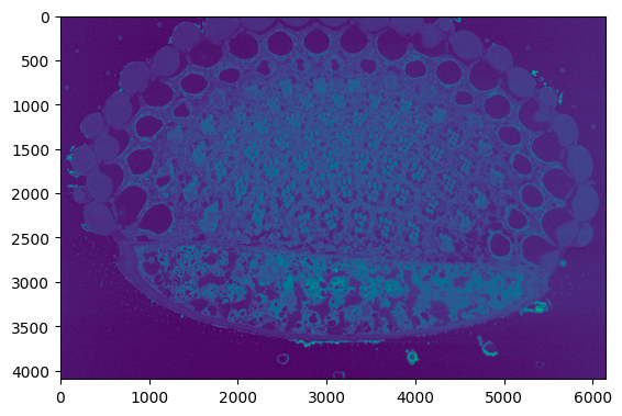 normalized image