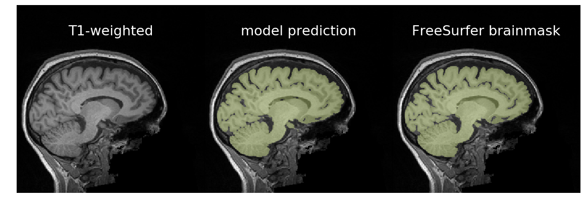 Model's prediction of brain mask