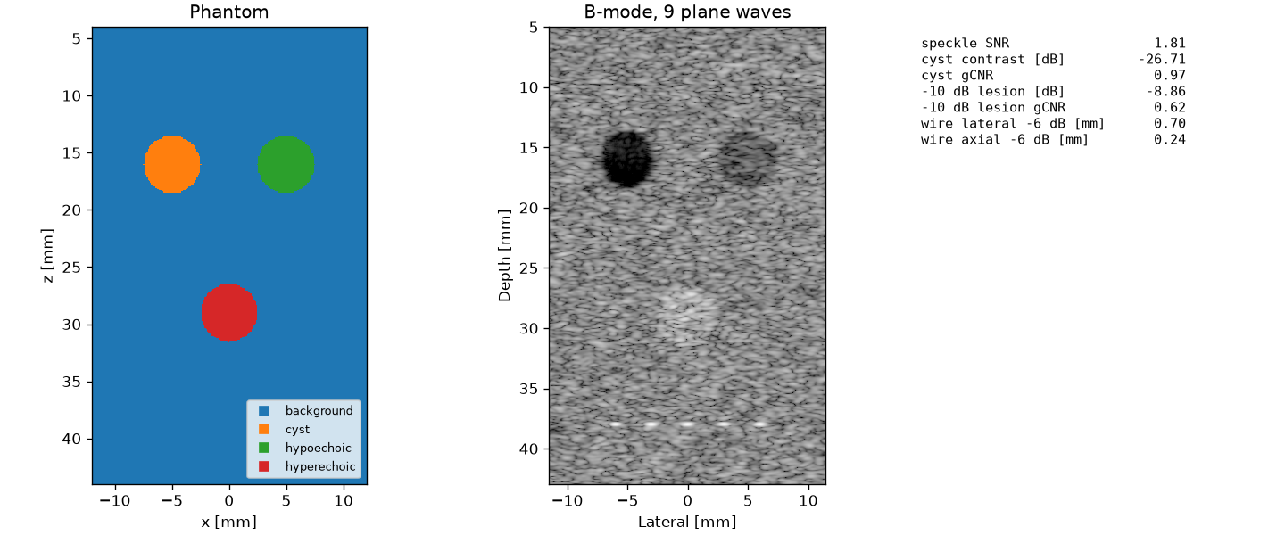 B-mode image of a simulated phantom with a cyst, two lesions and wire targets