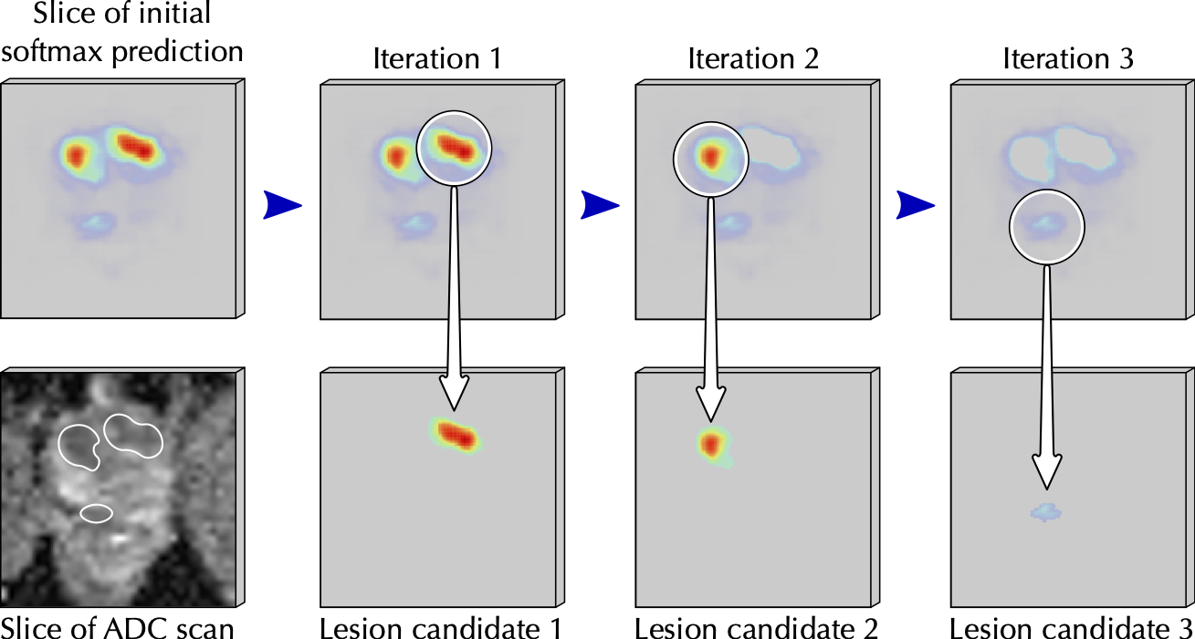 dynamic-lesion-extraction