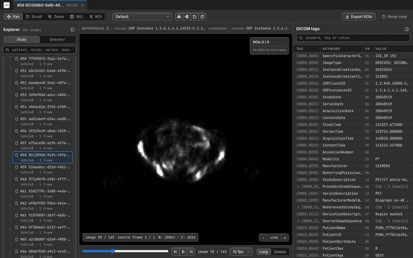 PET cine playback in dcmview