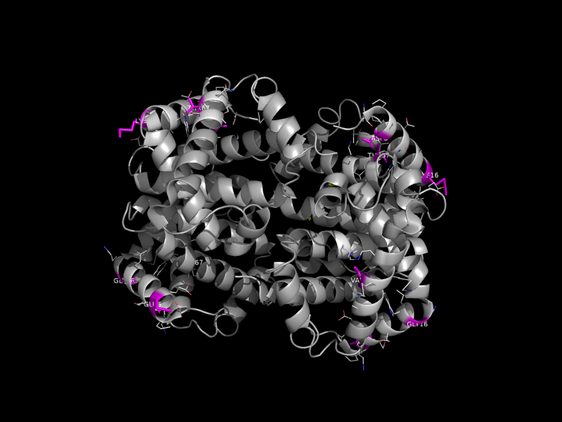 Mutation view of hemoglobin (4HHB) showing E6V, K16E, V67F