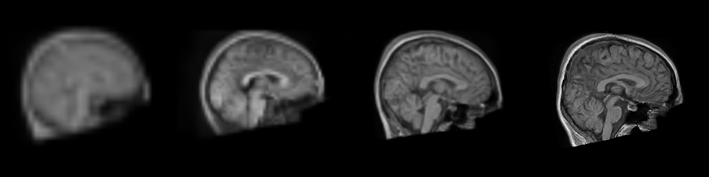 Model's generation of brain (sagittal)