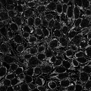 Skeleton — input mask