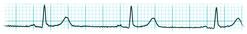 ECG Dicom Convert