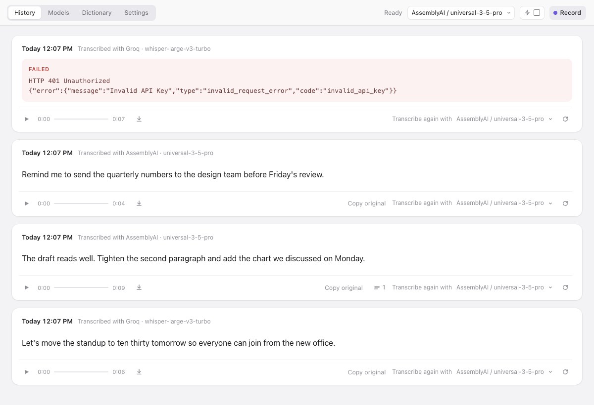 Entune history: recordings, transcripts, audio playback and retry