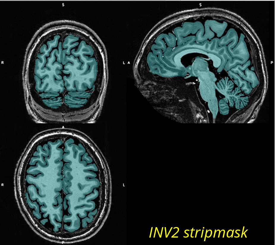 Strip mask from INV2