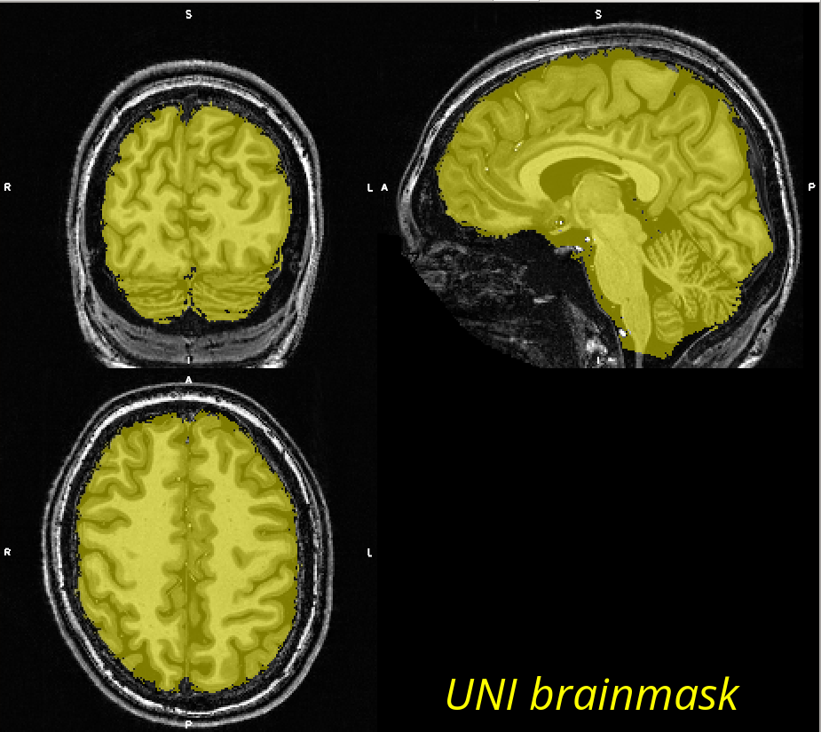 Brain mask from the MPRAGEised UNI