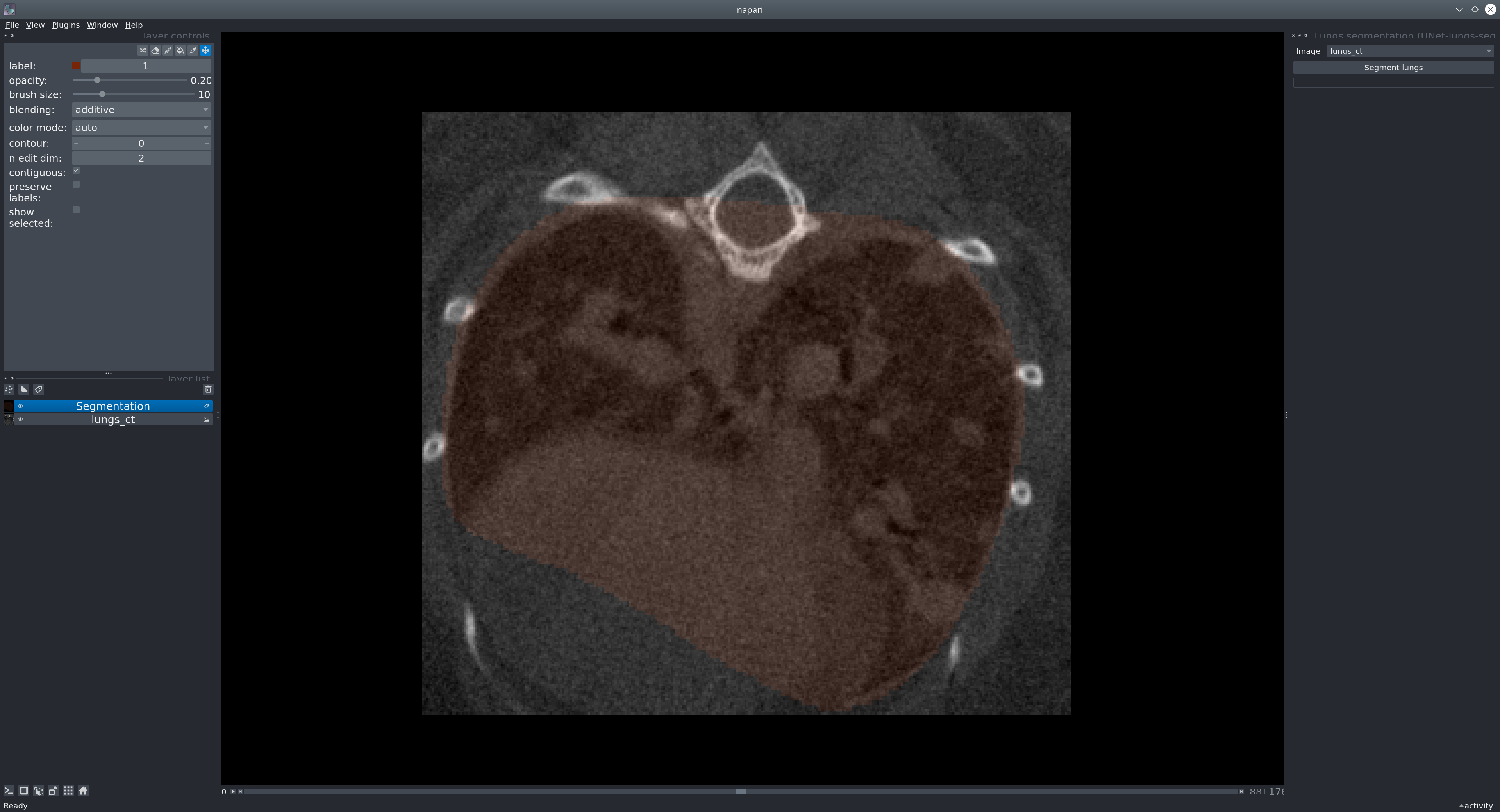 unet-lungs-segmentation · PyPI