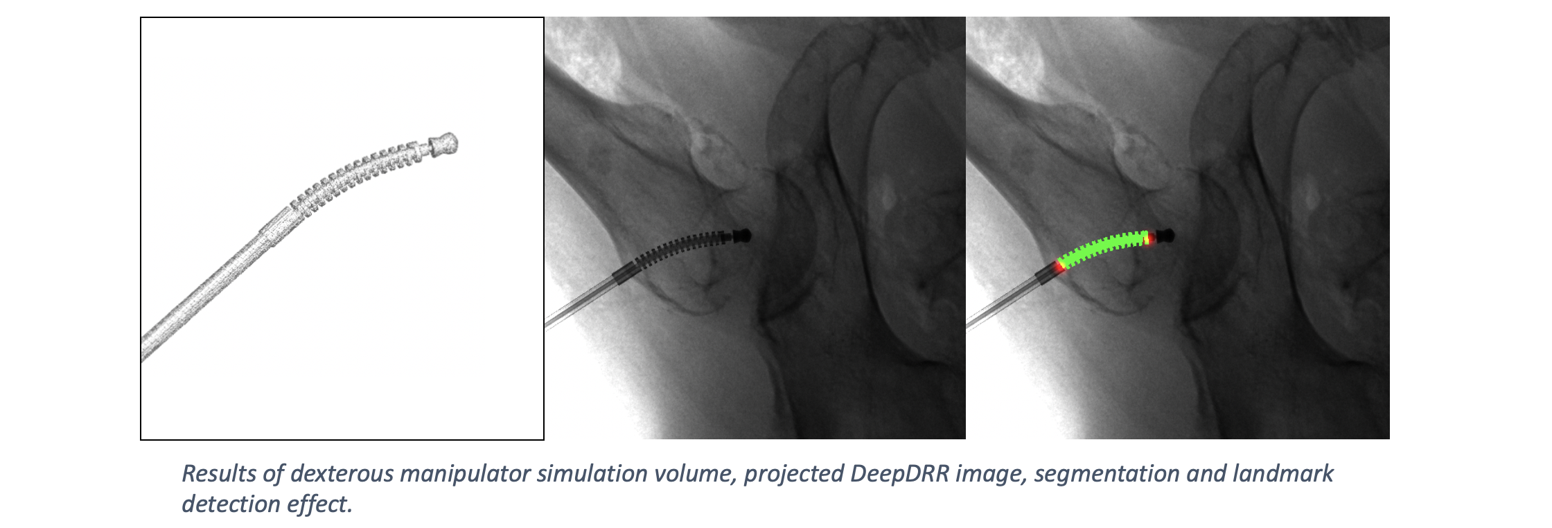 Robot Insertion and Detection