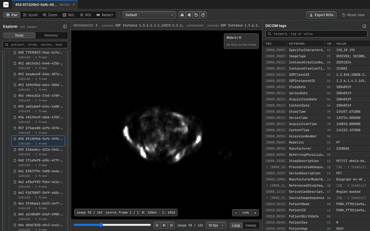 PET cine playback in dcmview