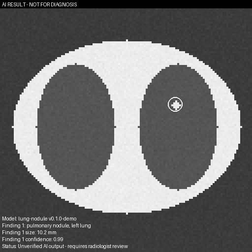 AI key image returned to PACS