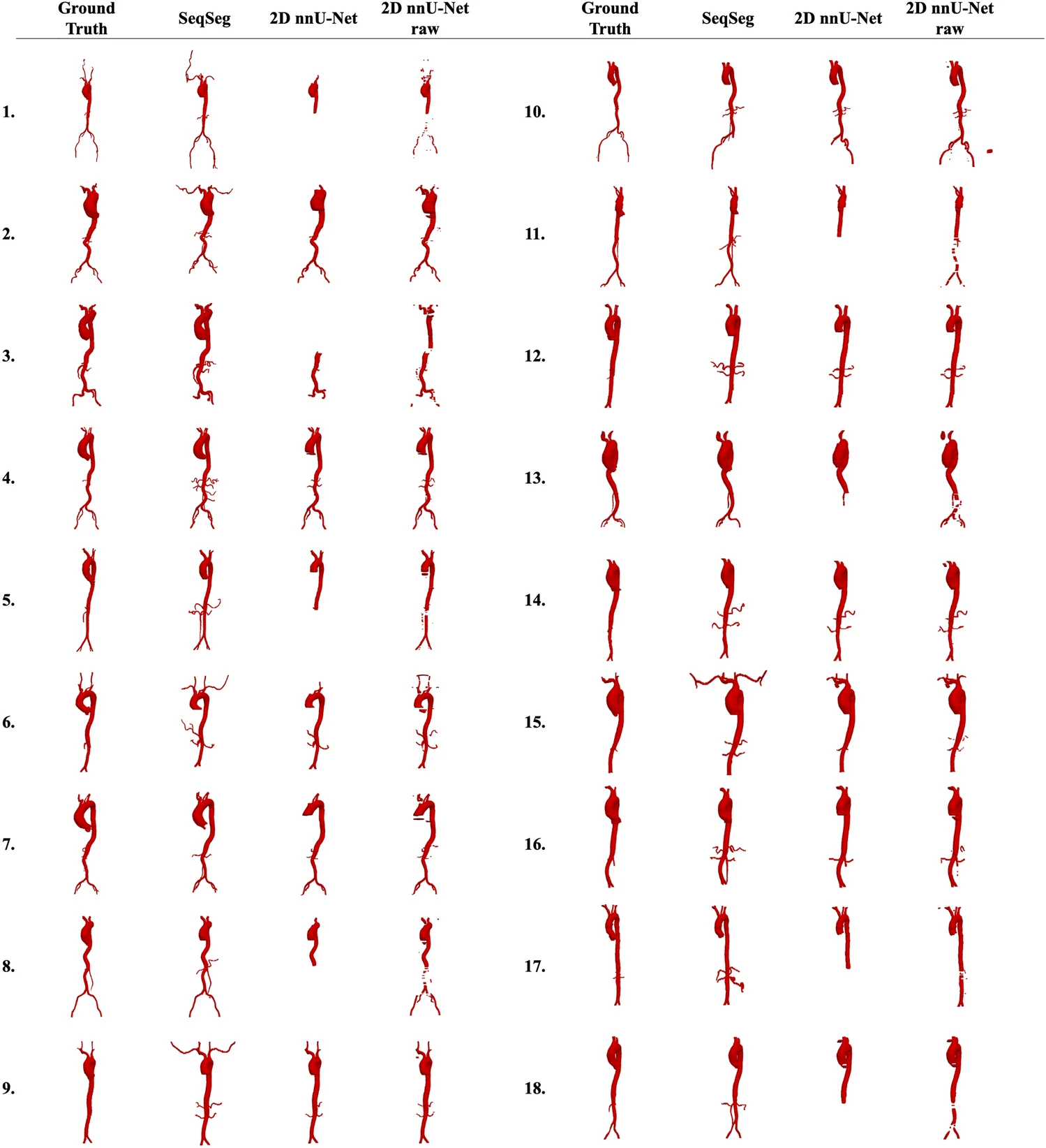 Aortic segmentation: SeqSeg vs. 2D nnU-Net on the ATV dataset