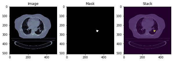 p1