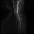 Avatar for mdsumner from gravatar.com