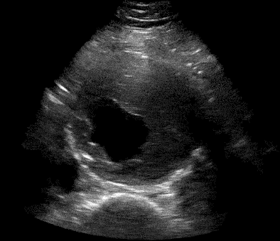 extracted_aorta-0
