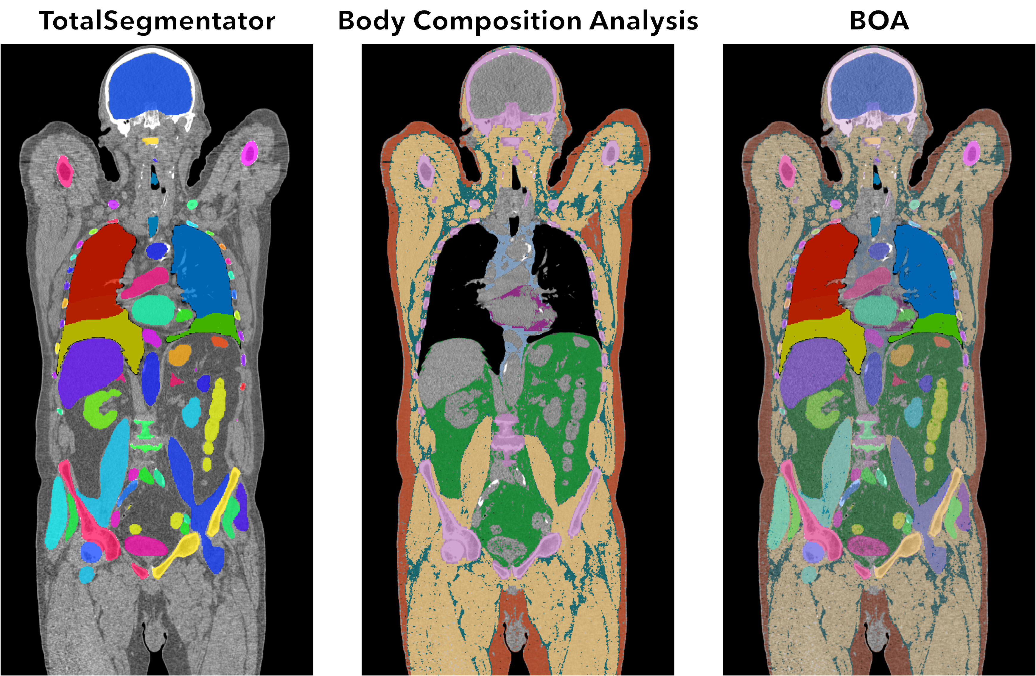 Segmentation of human body