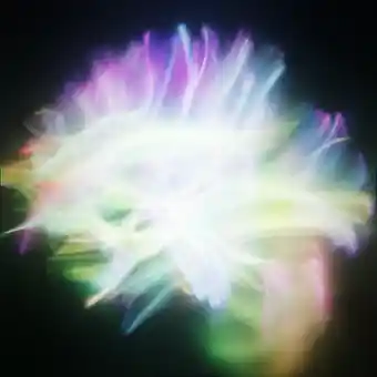 Human White-Matter Tractography — 87 dMRI tracts