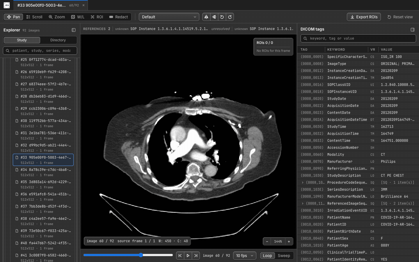 Chest CT cine playback in dcmview