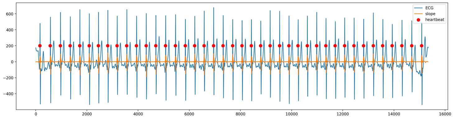 ECG heartbeat calculation fast