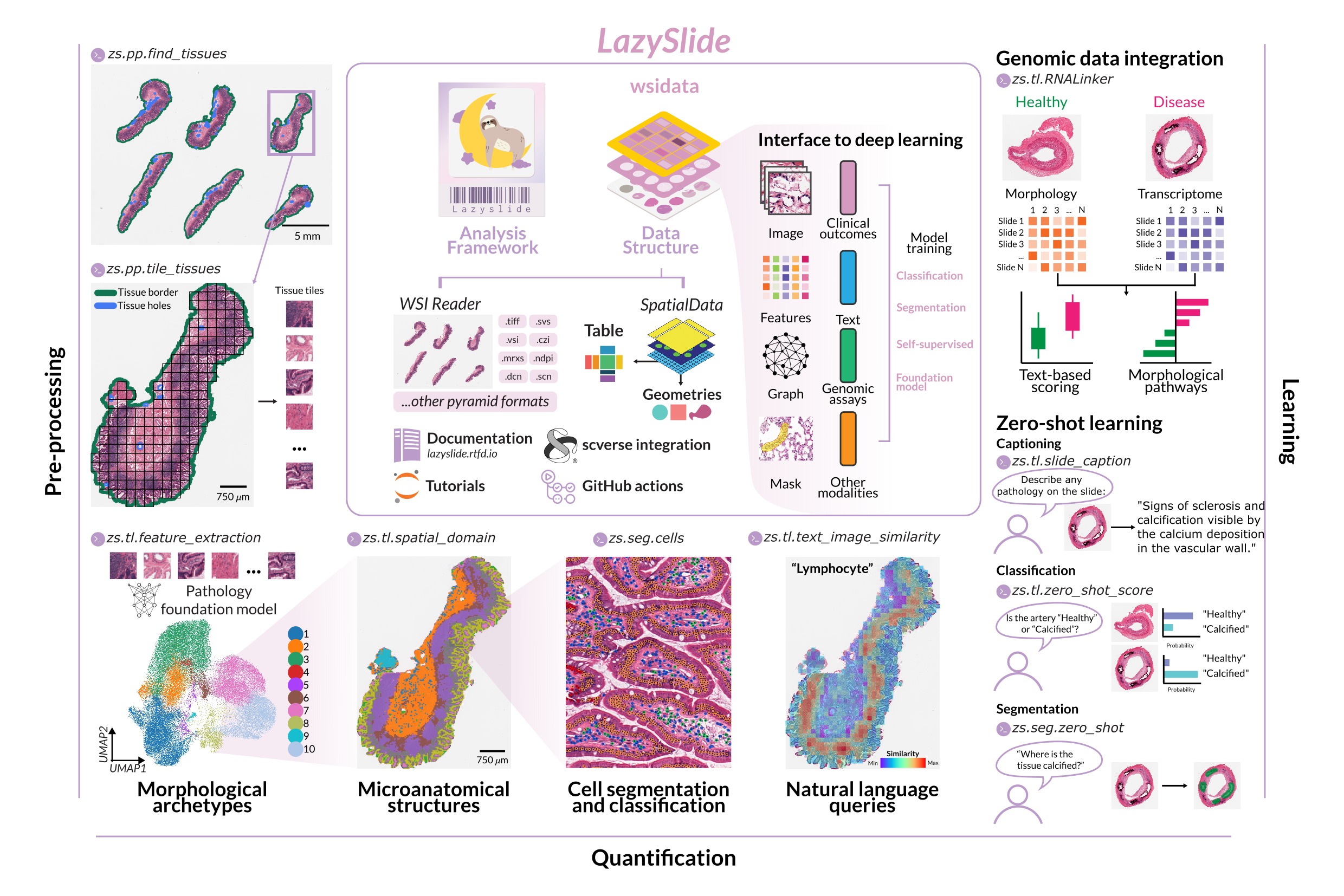 LazySlide overview: tissue segmentation, tiling, foundation-model feature extraction, cell segmentation, spatial domains, zero-shot classification and captioning, genomic data integration
