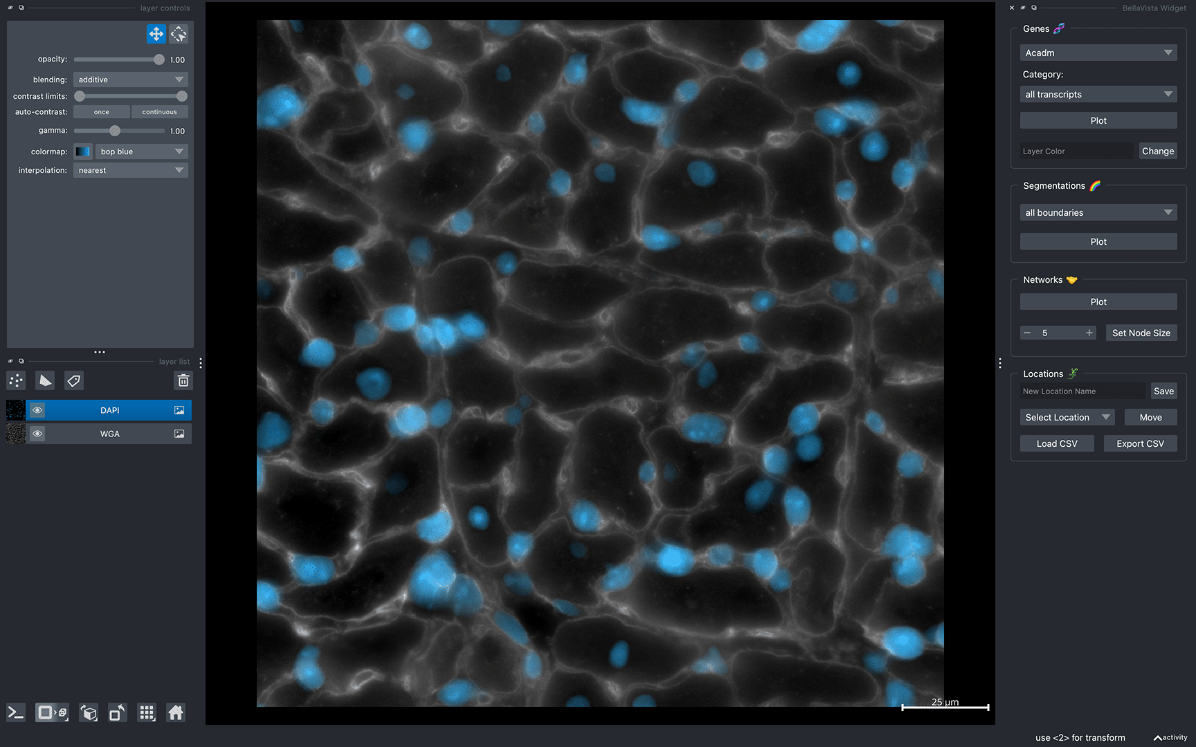 BellaVista demo sample TAC dataset initial screen