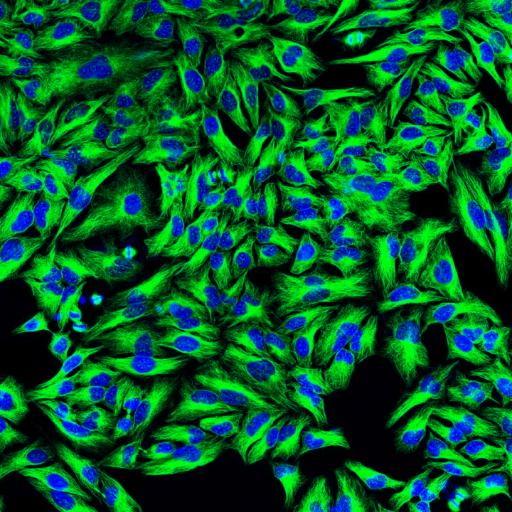 Original fluorescence microscopy image