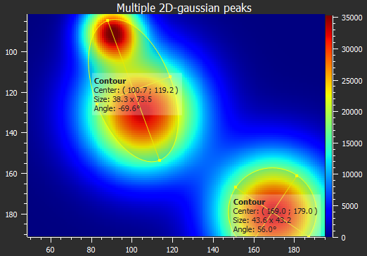 Contour detection