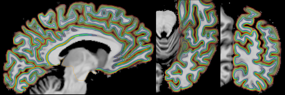 FreeSurfer segmentation and laminar surfaces