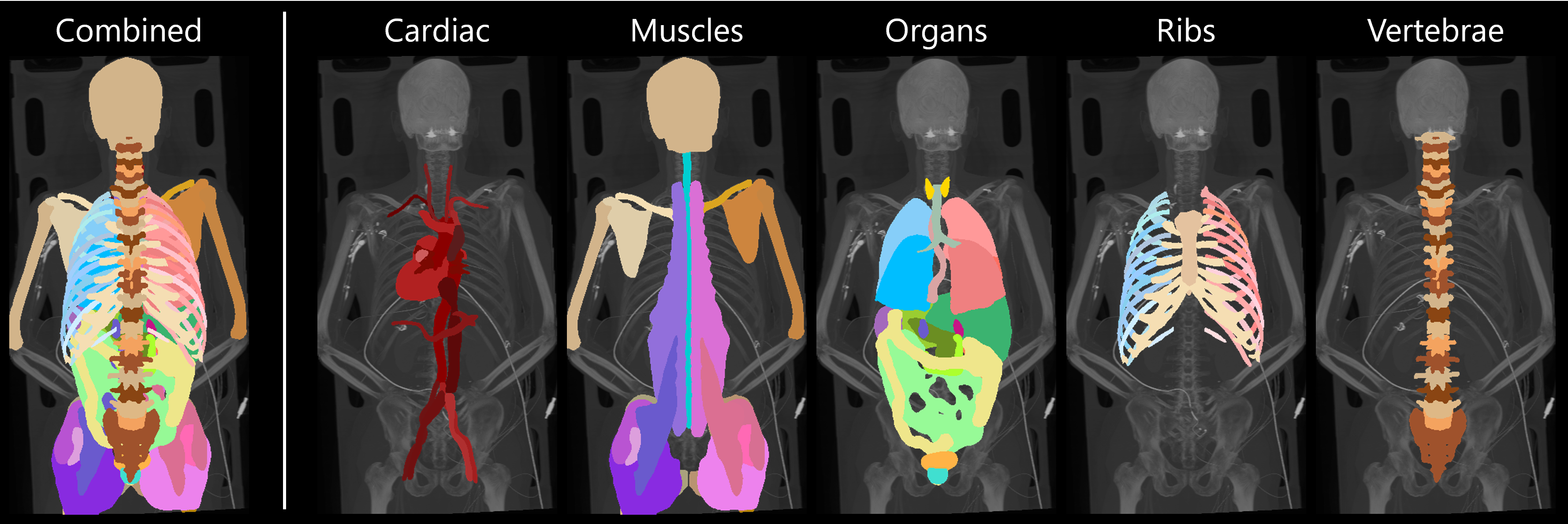 Example segmentation results.