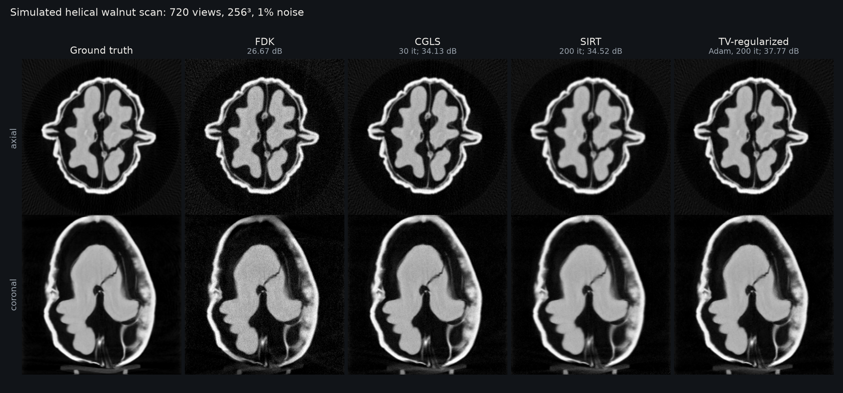 Simulated helical scan of the walnut: FDK, CGLS, SIRT and TV reconstructions