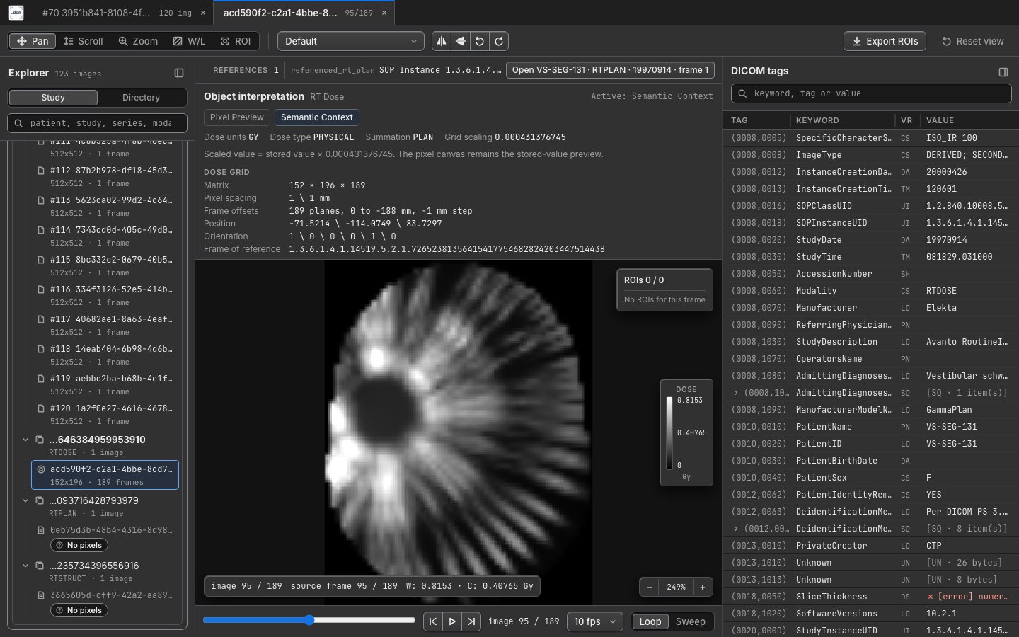 RT Dose semantic context in dcmview
