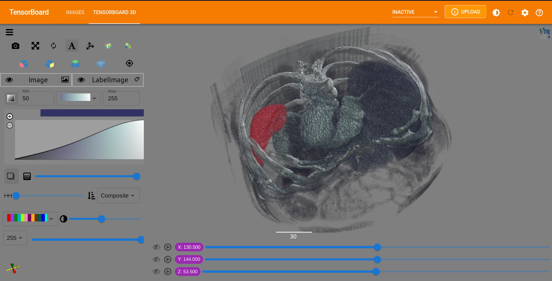 Spleen Image with Label