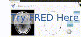 try fred