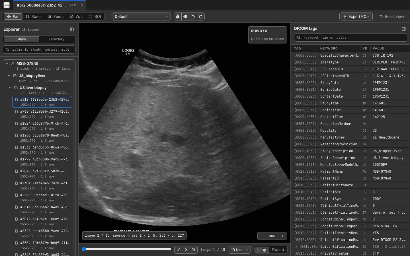 Ultrasound cine playback in dcmview