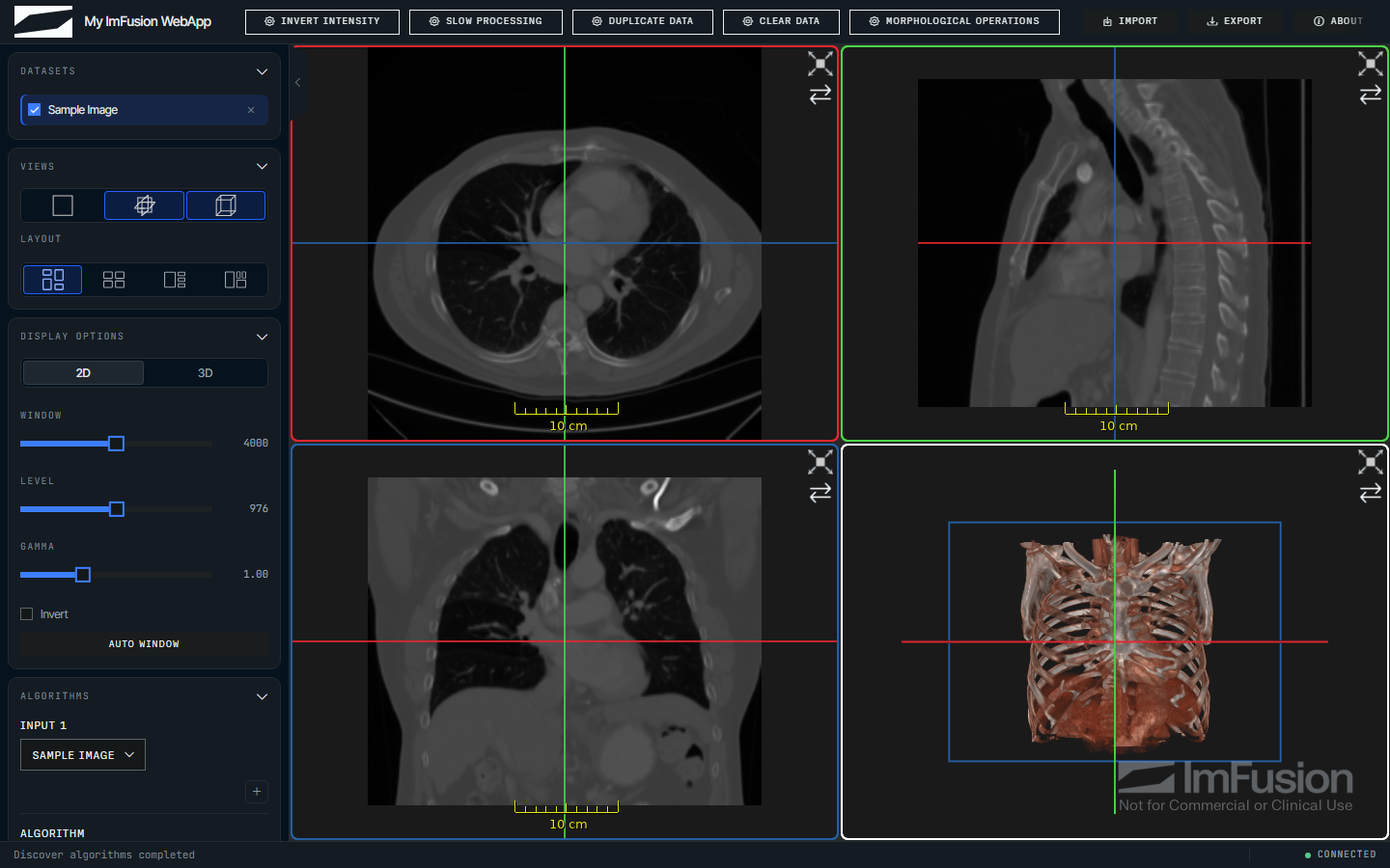 The WebAppKit demo in a browser: a CT volume in three orthogonal views and a 3D rendering, with a sidebar of datasets, layout and display controls and a row of algorithm buttons in the header.