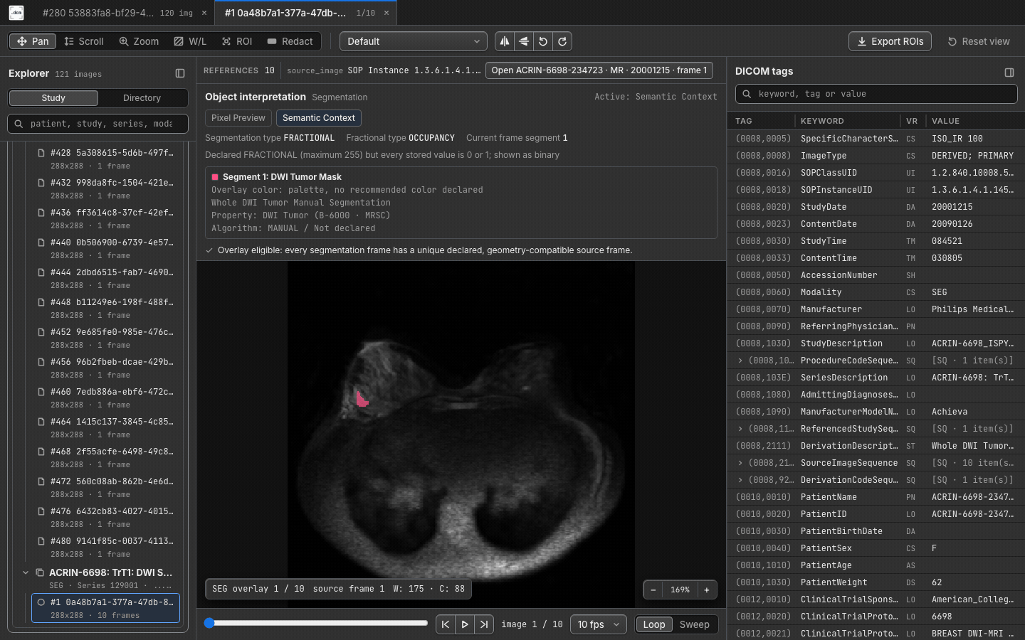 DICOM SEG semantic overlay in dcmview