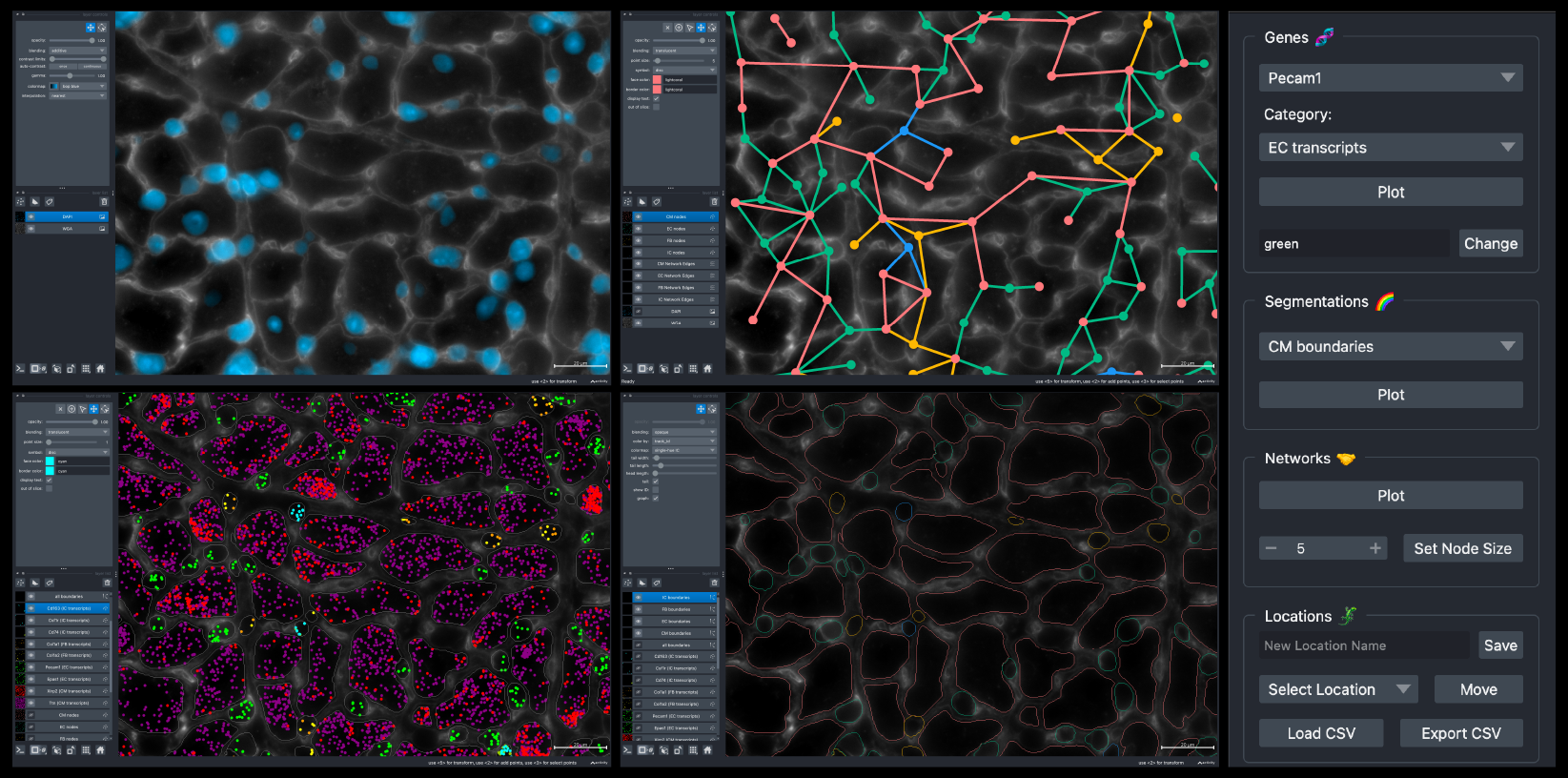 BellaVista demo sample TAC dataset