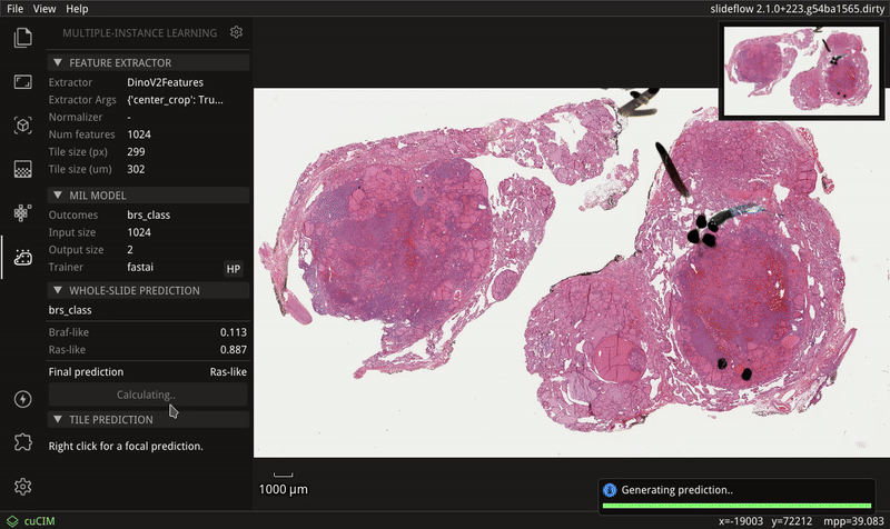 Slideflow Studio: a visualization tool for interacting with models and whole-slide images.